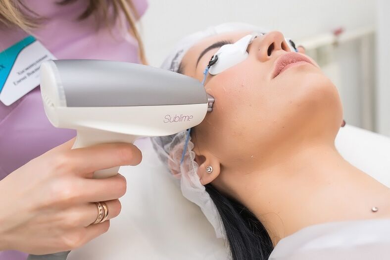 conducting a procedure for laser skin rejuvenation