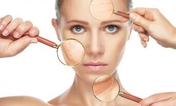 what skin problems laser fractional rejuvenation solves